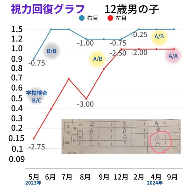 視力回復グラフNH
